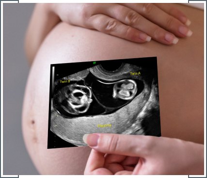 Twin-Twin Transfusion Syndrome